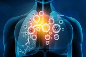 How to Boost Your Immune System Naturally