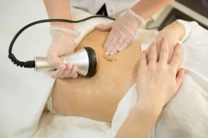 How Busy Moms Use Cavitation Machines to Feel Good Again