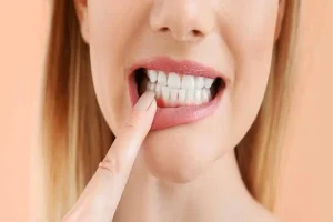 Before You Pay for a Root Canal: 8 Questions About the Total Cost